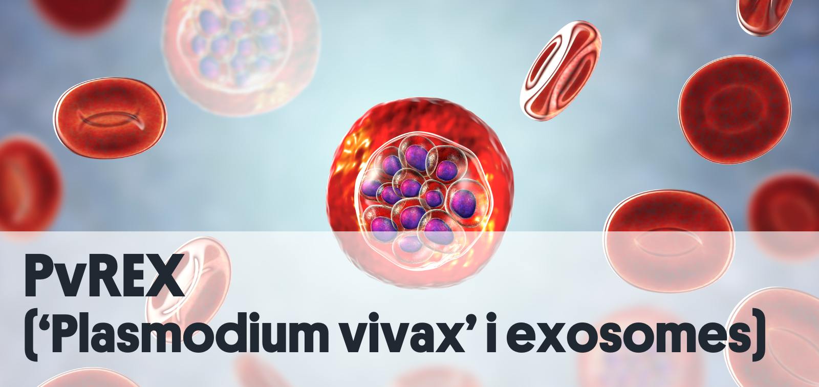 Protozou Plasmodium vivax dins de glòbuls vermells, il·lustració per ordinador.