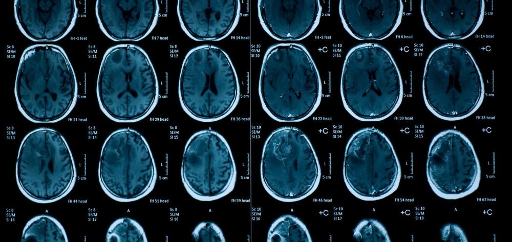 Las altas temperaturas afectan a la función cerebral