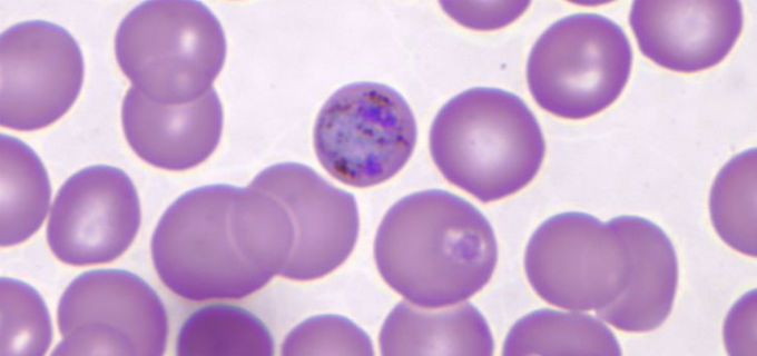 plasmodium vivax images