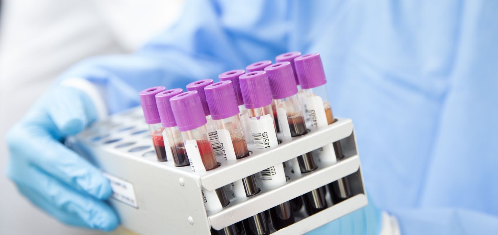 GlycoTools project. Probing Plasmodium falciparum glycosylation and related metabolic pathways to devise new tools against malaria.