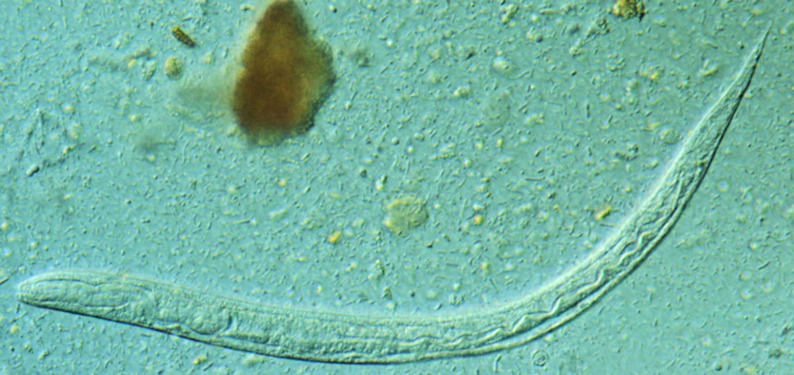 Strongyloides stercoralis larva